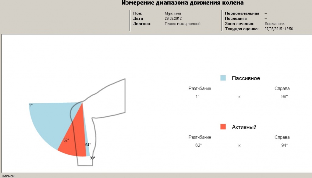 Диапазон в колене.jpg Диапазон в колене.jpg