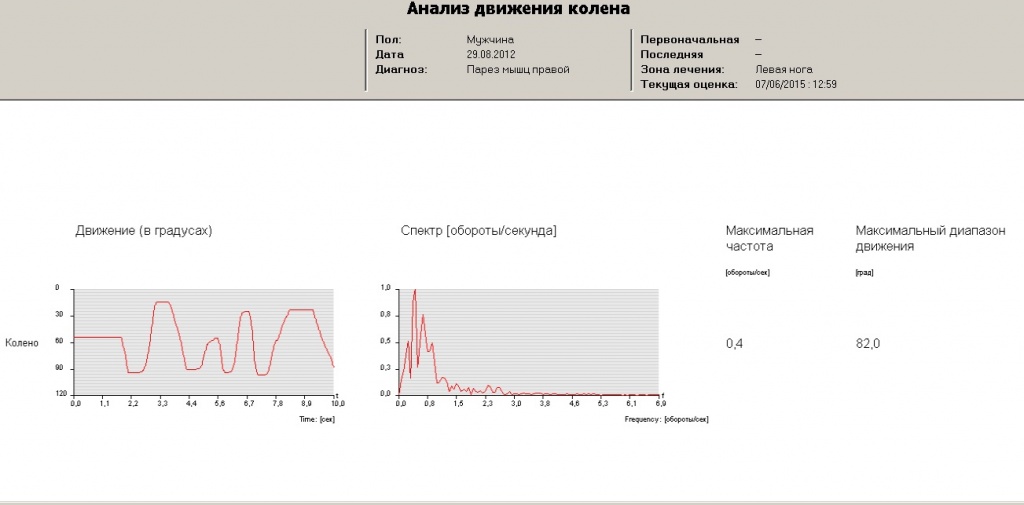 Анализ в колене.jpg Анализ в колене.jpg