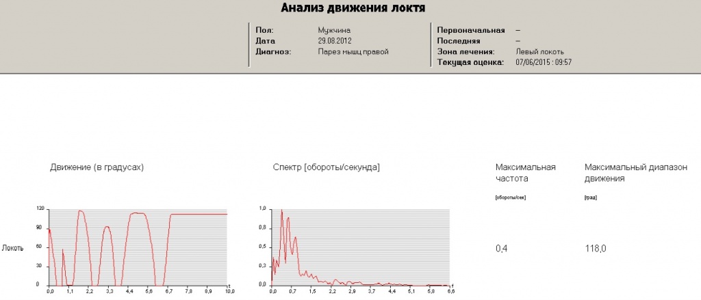 Анализ движения в локте.jpg